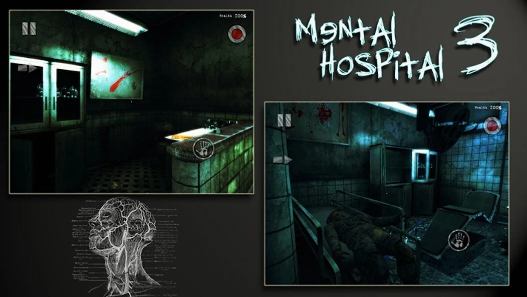 Mental Hospital III Remastered screenshot 1